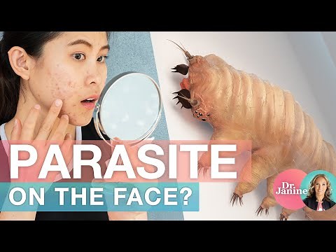 Parasites on the Face? | Dr. J9 Live