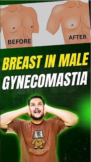 Breast Development in males ( Gynecomastia) #biology #gynecomastia #genetics #science