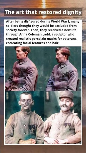 This artist gave new life to disfigured World War I soldiers