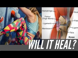 Let's Talk About Your Meniscus Tear...| Will It Heal?