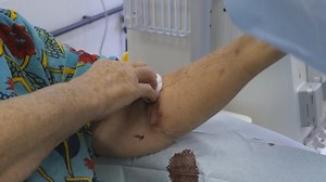 Hemodialysis Machine Artificial Kidney Stock Footage Video (100% Royalty-free) 1021812616 | Shutterstock