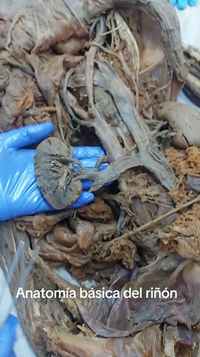 Anatomía básica del riñón humano: estructuras y zonas