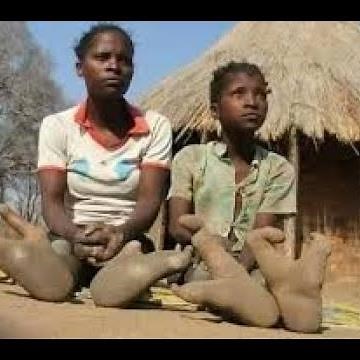 Vadoma: Ostrich-footed Tribe of Zimbabwe