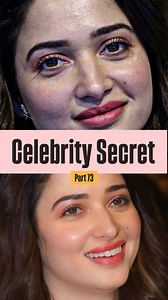 Comment “ Face “ to get the scrub link. Clear skin secret of celebrities are finally revealed. ✨❤️🥰😍 Facing open pores , whiteheads and blackheads on the face is the thing of past for me. Using @chemistatplay.skincare ‘s Gentle exfoliating scrub is a game changer as it deeply cleanses dirt and impurities leaving my face absolutely clear , unclogged wjth zero blackheads and whiteheads issue. Also minimises my pores with the goodness of both the worlds like physical exfoliants walnut shell powde