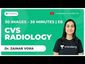 30 Images in 30 minutes | E6 | CVS Radiology | NEET PG | Dr. Zainab Vora