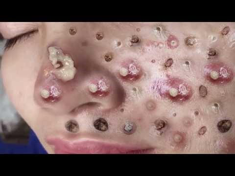 𝑺𝒐𝒐𝒕𝒉𝒊𝒏𝒈 𝑭𝒂𝒄𝒊𝒂𝒍 𝑻𝒓𝒆𝒂𝒕𝒎𝒆𝒏𝒕 𝒇𝒐𝒓 𝑺𝒕𝒓𝒆𝒔𝒔 𝑹𝒆𝒍𝒊𝒆𝒇 | 𝑫𝒆𝒆𝒑 𝑪𝒍𝒆𝒂𝒏𝒊𝒏𝒈 & 𝑪𝒂𝒍𝒎𝒊𝒏𝒈 𝑴𝒂𝒔𝒔𝒂𝒈𝒆 𝒂𝒕 𝑳𝒖𝒙𝒖𝒓𝒚 𝑺𝒑𝒂 #887581