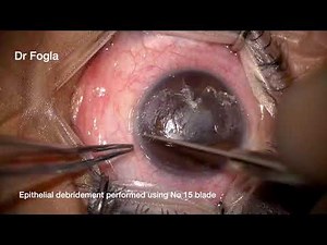 BSK removal using K2 EDTA