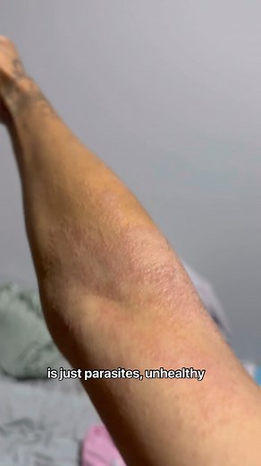 ✺Cut processed foods, sugar, dairy, gluten, starch, wheat, alcohol, etc. Buy natural products with less ingredients and be mindful of what goes on your skin. There are holistic versions of everything from self care to household to hygiene. Burdock Root & Yellow Dock are known blood cleansers, high in iron and vitamin C. ✺For Herbal Blends & Wellness → View Highlights 🌱 | PlantofZen