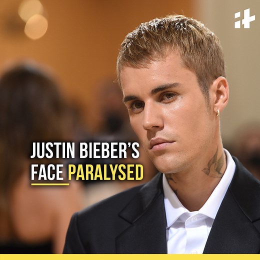 27K views · 474 reactions | Justin Bieber is suffering from the Ramsay Hunt Syndrome, which causes facial paralysis. | Indiatimes | Facebook