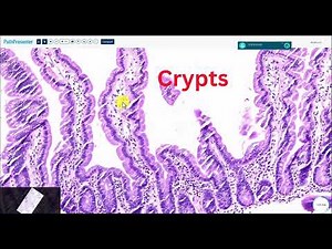 Histology of Duodenum