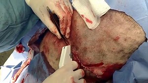 4.1K views · 54 reactions | Removal of massive lipoma from dog. | Pharmacy Era | Facebook