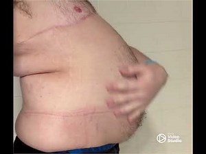 Water hose belly inflation video (no sound) super round and full results