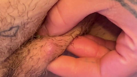 Ingrown Hair turned Cyst (?)