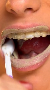 8K views · 98 reactions | L'argile verte va faire une entrée fracassante dans ta routine ! | Re-belle | Facebook