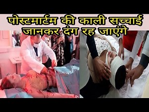 Postmortem की काली सच्चाई || डर जाते हैं डॉक्टर जब postmortem करते समय चीखती है बॉडी