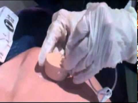 How a Nurse Flushes a Port