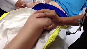 Reducing a dislocated patella