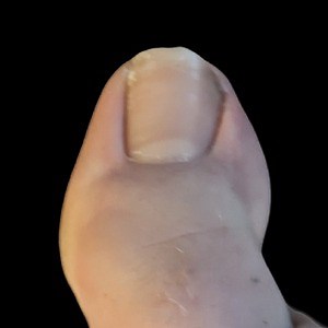 toestreams - Twitch