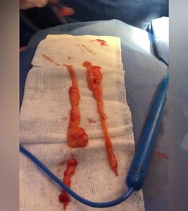 56K views · 148 reactions | El bichat y la rinoplastia harán que tu cara logre un contorno más simétrico y armonioso. Agenda ya tu cita al 5012 6549 o 5393 8901. | Corpus & Rostrum | Facebook