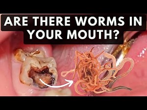 Are there WORMS in your TOOTH? | Let's find out!