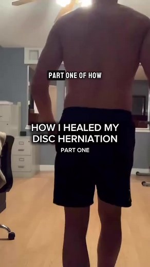 Disc Herniation Treatment: Extension Exercises That Helped Me (Part 1)