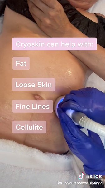 In areas such as:🦵Back of Legs💪Back of arms🫄Abdominal Area🤔Under ChinFor any questions or concerns contact us! Send us a email or📞(909) 552-0701www.allaestheticskare.com📍371 N Central Ave, Upland, Ca 91786#freezethefat #skincarespecialist #ivvitamintherapy #directbilling #notjustforwomen #chiropodist #agespots #ivdrips #radiofrequency #microdermabrasion #manuallymphaticdrainag