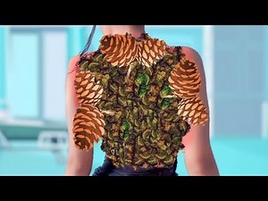 ASMR Animation |Remove Dog Tick, Botfly, Pimple popping, barnacle in nest Infested girl back body |