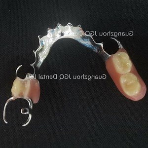 [Hot Item] Flexible Dentures Dental Removable Metallic Partial Dentures with Cobalt Chrome Alloy for Dentist with Beautiful Clasp in China Dental Lab