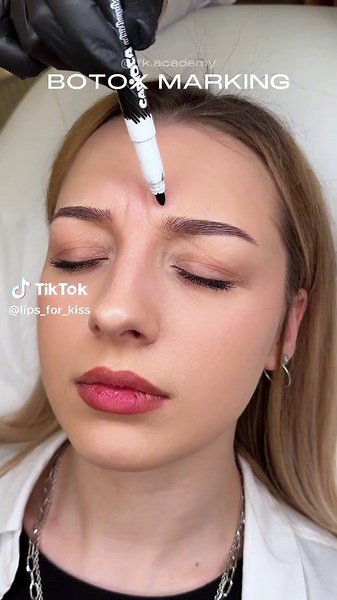 Botox Eyebrow Lift Technique: Learn from Experts