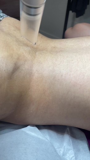 skinglamlaser on TikTok