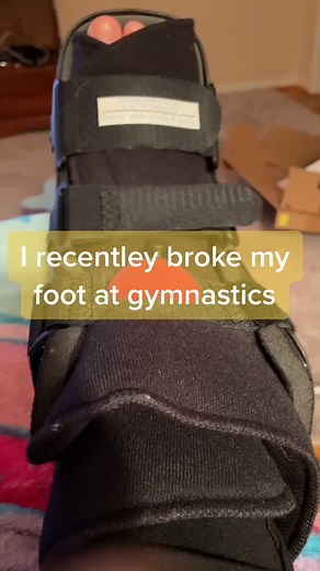 Broken foot on TikTok
