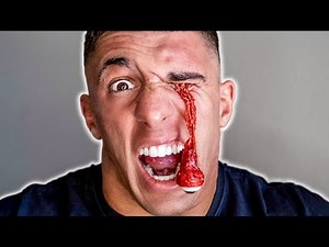 MY EYEBALL POPPED OUT!