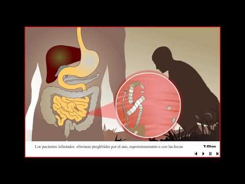 Taenia Solium - Solitaria