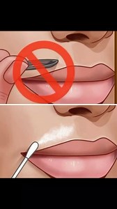 ⚠️ Attention aux méthodes maison pour l'épilation faciale ⚠️ Le bicarbonate de soude est un ingrédient aux multiples usages, mais son efficacité pour l’épilation faciale n’est pas prouvée scientifiquement. De plus, il peut être agressif pour la peau, surtout sur le visage, où l’épiderme est plus fin et sensible. 🔴 Risques potentiels : - Irritations et rougeurs dues à son pH alcalin. - Sécheresse cutanée et perturbation de la barrière cutanée. - Réactions allergiques ou inflammatoires, surtout s