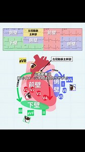 心筋梗塞を絵でわかりやすく解説｜冠動脈別のST変化の見方