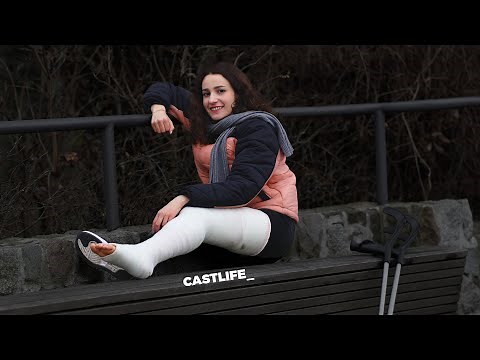 Camille very long leg pointed cast - her first, a lot of crutching