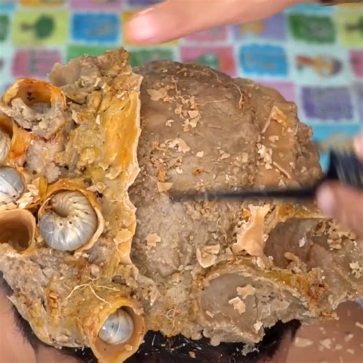 11K views · 73 reactions | Dandruff Removal Mangot Worms On Hole Scalp #1687 #ticks #removetick #Dandruff #dandrufftreatment #dandruffremoval | Help remove ticks | Facebook