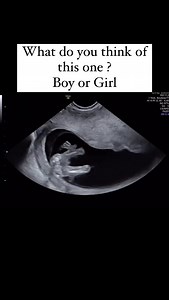 17K views · 19 reactions | Boy or Girl?  A big thanks to my...