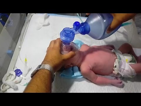 Emotional Birth Story: Baby Delivered by NVD With Delayed Cry | Full Recovery After Resuscitation