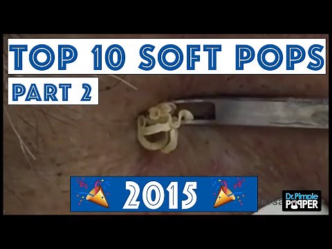 My Top 10 BEST Blackhead Pops of 2015: Part 2, #1-#3