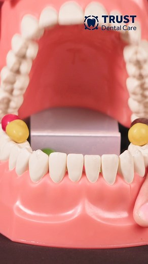 PEANUT M&M ASMR 樂 #asmr #enjoy #peanut #chocolate #mexicodentistry | Trust Dental Care - Dentist in Tijuana | Facebook