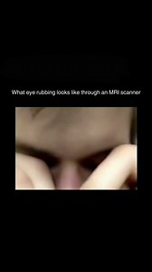 15K views · 26 reactions | It is recommended to avoid rubbing your...