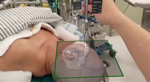 Skye Prince Med Bed on TikTok