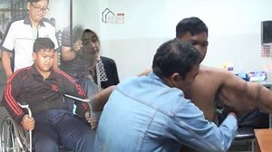 Aria Permana Diet Hingga Turun 112 Kg Kini Operasi Plastik, Biaya Rp 30 Juta, Ortu Tak Keluar Uang - Tribunmadura.com