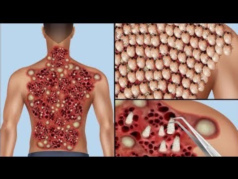 ASMR Doctor Roleplay Animation 🎧 | Stress Relief & Calm Sounds