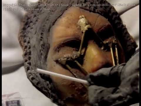 Apollo 20 Autopsy inside the lunar module Endymion