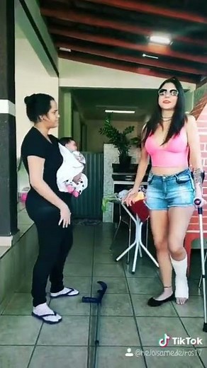 SHORT LEG CAST TIK TOK #tiktok #shorts