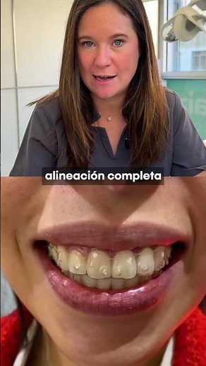 Ortodoncia sin complicaciones con Invisalign 💎