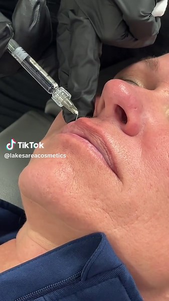 Come in and get your lips done!! 👸💋✨ #lips#cosmeticbar#weloveourclients#aitkin#brainerd#nisswa#baxter