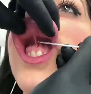 8K views · 57 reactions | Piercing :O  | Funniest Videos ever | Facebook
